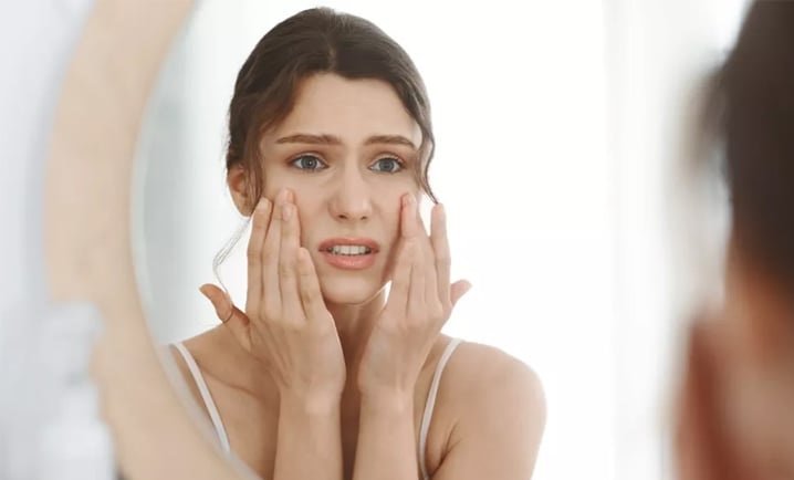 ত্বকে ব্রণ