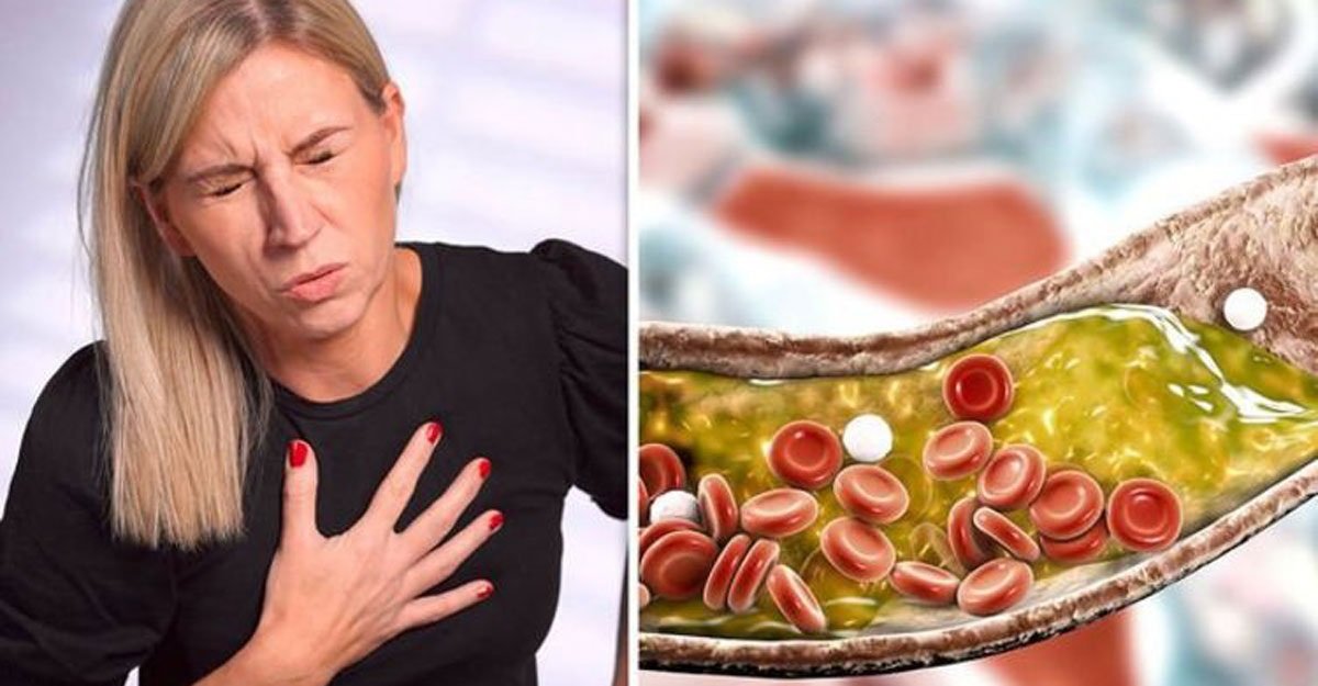 কোলেস্টেরল